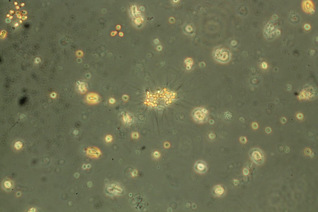 Micractinium pusillum
