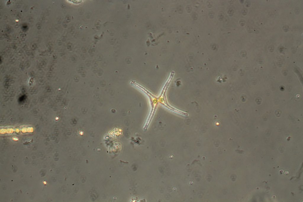 Staurodesmus chaetoceros